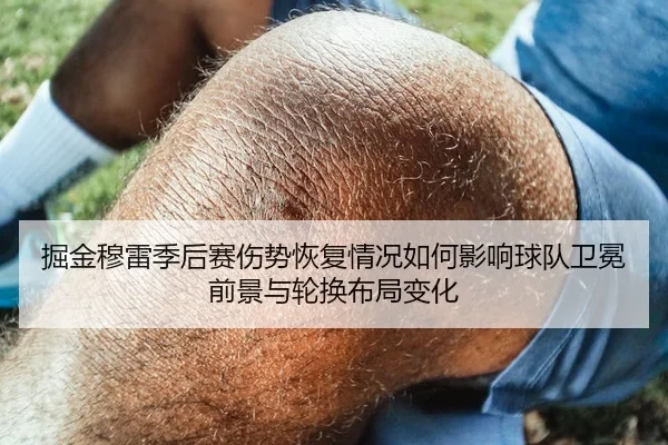 掘金穆雷季后赛伤势恢复情况如何影响球队卫冕前景与轮换布局变化